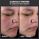 Paula's Choice Skin Perfecting 2% BHA Liquid Salicylic Acid Exfoliant, Gentle Facial Exfoliator for Blackheads, Large Pores, Wrinkles & Fine Lines, Travel Size, 1 Fluid Ounce-UPStoxs