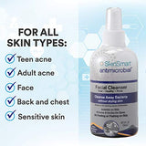 SkinSmart Facial Cleanser for Acne, Targets Bacteria for Active Teenage Athletes Post Workout and Adult Acne, 8 oz Spray Bottle, Safe for Multiple Daily Uses-UPStoxs
