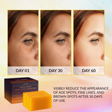 VALITIC Kojic Acid Dark Spot Remover Soap Bars with Vitamin C, Retinol, Collagen, Turmeric - Original Japanese Complex Infused with Hyaluronic Acid, Vitamin E, Shea Butter, Castile Olive Oil (3 Pack)-UPStoxs