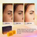 VALITIC Kojic Acid Dark Spot Remover Soap Bars with Vitamin C, Retinol, Collagen, Turmeric - Original Japanese Complex Infused Hyaluronic Acid, E, Shea Butter, Castile Olive Oil (4 Pack)-UPStoxs