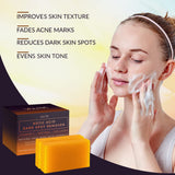 VALITIC Kojic Acid Dark Spot Remover Soap Bar with Vitamin C,Retinol,Collagen,Turmeric - Original Japanese Complex Hyaluronic Acid,E,Shea Butter,Castile Oil (2 Pack) With Holder,Pack of 3,3.5 ounces-UPStoxs